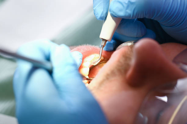 Best Emergency Denture Repair in Lewisville, TX