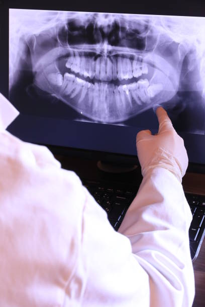 Best Emergency Wisdom Tooth Extraction in Lewisville, TX