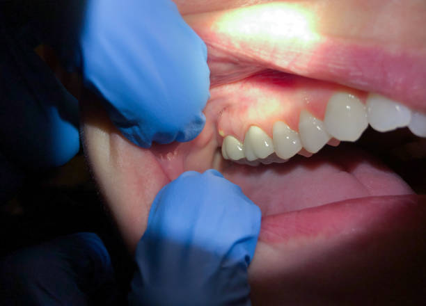 Best Emergency Treatment for Jaw Pain or Injury in Lewisville, TX